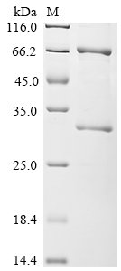 Recombinant Pseudomonas aeruginosa Exotoxin A regulatory protein (toxR)