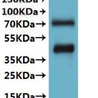 CSB-MP5452MOV is detected by Mouse anti-6*His monoclonal antibody.