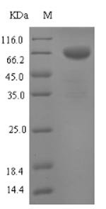 Recombinant Mouse Tryptophan 5-hydroxylase 1 (Tph1)