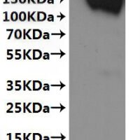 CSB-MP021581HU(F2)-C is detected by Mouse anti-6*His monoclonal antibody.