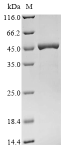 Recombinant Mouse E3 ubiquitin-protein ligase TRIM63 (Trim63), Mus musculus (Mouse), E.coli, N-terminal 10xHis-tagged and C-terminal Myc-tagged, 46.9kDa, purity >90% as determined by SDS-PAGE.