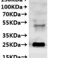 CSB-MP6061GYI is detected by Mouse anti-6*His monoclonal antibody.