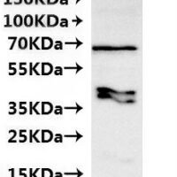 CSB-MP6057CXP(M1) is detected by Mouse anti-6*His monoclonal antibody.