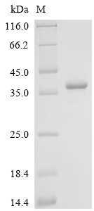 Recombinant Human cytomegalovirus Protein UL141 (UL141), partial, Human cytomegalovirus (strain Merlin) (HHV-5) (Human herpesvirus 5), E.coli, N-terminal 10xHis-tagged and C-terminal Myc-tagged, 35.2kDa, purity >90% as determined by SDS-PAGE.