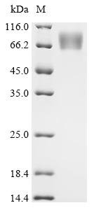 Recombinant Human cytomegalovirus Protein UL16 (UL16), partial, Human cytomegalovirus (strain AD169) (HHV-5) (Human herpesvirus 5), Mammalian cell, C-terminal hFc1-tagged, 46.6kDa, purity >95% as determined by SDS-PAGE.