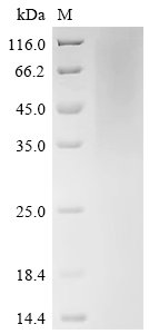Recombinant Human cytomegalovirus Protein UL16 (UL16), partial, Human cytomegalovirus (strain AD169) (HHV-5) (Human herpesvirus 5), Yeast, C-terminal 6xHis-tagged, 19.2kDa, purity >90% as determined by SDS-PAGE.