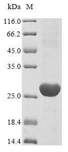 Recombinant Mouse Uroplakin-3a (Upk3a), partial, Mus musculus (Mouse), E.coli, N-terminal 10xHis-tagged and C-terminal Myc-tagged, 25.5kDa, purity >85% as determined by SDS-PAGE.