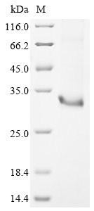 Recombinant Mouse Usherin (Ush2A), partial, Mus musculus (Mouse), E.coli, N-terminal 6xHis-tagged, 33.3kDa, purity >90% as determined by SDS-PAGE.