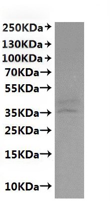 Recombinant Macaca fascicularis C5a anaphylatoxin chemotactic receptor 1 (C5AR1)-VLPs Protein, Macaca mulatta (Rhesus macaque), Mammalian cell, C-terminal 10xHis-tagged, 38.3kDa, purity >VLPs