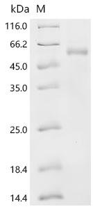 Recombinant Human Tyrosinase (TYR), partial Protein, Homo sapiens (Human), Baculovirus, C-terminal 6xHis-tagged, 50.8kDa, purity >85% as determined by SDS-PAGE.