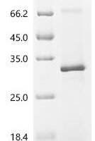 (Tris-Glycine gel) Discontinuous SDS-PAGE (reduced) with 5% enrichment gel and 15% separation gel.