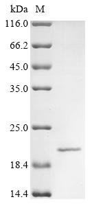 Recombinant Human immunodeficiency virus type 1 group M subtype C Protein Vpr (vpr), Human immunodeficiency virus type 1 group M subtype C (isolate 92BR025) (HIV-1), E.coli, N-terminal 10xHis-tagged and C-terminal Myc-tagged, 18.9kDa, purity >85% as determined by SDS-PAGE.