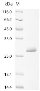 Recombinant Human immunodeficiency virus type 1 group M subtype G Protein Vpr (vpr), Human immunodeficiency virus type 1 group M subtype G (isolate SE6165) (HIV-1), E.coli, N-terminal 6xHis-KSI-tagged, 26.7kDa, purity >90% as determined by SDS-PAGE.