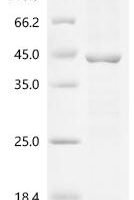 (Tris-Glycine gel) Discontinuous SDS-PAGE (reduced) with 5% enrichment gel and 15% separation gel.