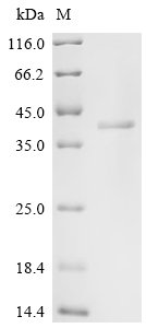 Recombinant Mouse XIAP-associated factor 1 (Xaf1)