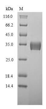 Recombinant Mouse 14-3-3 protein beta/alpha (Ywhab)