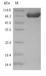Recombinant Proteus mirabilis Serralysin (zapA)