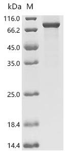 Recombinant Mouse Endoribonuclease ZC3H12A (Zc3h12a), Mus musculus (Mouse), E.coli, N-terminal 10xHis-tagged and C-terminal Myc-tagged, 73.0kDa, purity >85% as determined by SDS-PAGE.