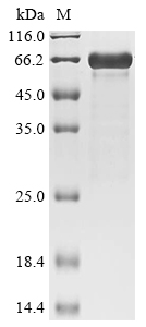 Recombinant Mouse Zinc finger protein 410 (Znf410), Mus musculus (Mouse), E.coli, N-terminal 10xHis-tagged and C-terminal Myc-tagged, 59.7kDa, purity >85% as determined by SDS-PAGE.
