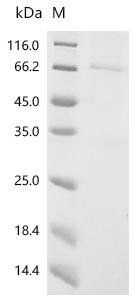 Recombinant Streptococcus pyogenes serotype M6 Streptolysin O (slo) Protein, Streptococcus pyogenes serotype M6 (strain ATCC BAA-946 / MGAS10394), in vitro E.coli expression system, N-terminal 10xHis-tagged, 65.2kDa, purity >90% as determined by SDS-PAGE.