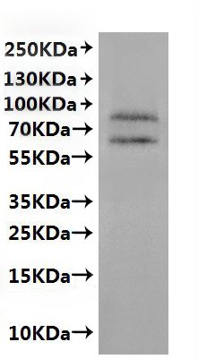 Recombinant Human Neuronal acetylcholine receptor subunit alpha-4(CHRNA4)-VLPs Protein, Homo sapiens (Human), Mammalian cell, C-terminal 10xHis-tagged(This tag can be tested only under denaturing conditions), 68.5kDa, purity >95% as determined by SEC-HPLC.