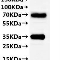 CSB-MP837739MO(A4) is detected by Mouse anti-6*His monoclonal antibody