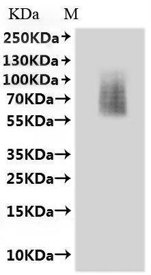 Recombinant Mouse C-X-C chemokine receptor type 3 (Cxcr3)-VLPs Protein, Mus musculus (Mouse), Mammalian cell, C-terminal 10xHis-tagged, 42.4kDa, purity >90% as determined by SEC-HPLC.