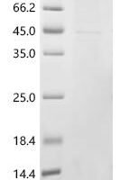 (Tris-Glycine gel) Discontinuous SDS-PAGE (reduced) with 5% enrichment gel and 15% separation gel.