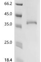 (Tris-Glycine gel) Discontinuous SDS-PAGE (reduced) with 5% enrichment gel and 15% separation gel.