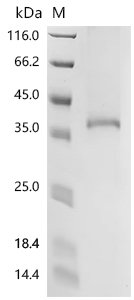 Recombinant Human C-C chemokine receptor type 4 (CCR4) Protein, Homo sapiens (Human), in vitro E.coli expression system, C-terminal 10xHis-tagged, 44.4kDa, purity >85% as determined by SDS-PAGE.