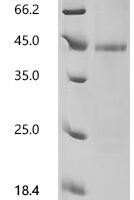 (Tris-Glycine gel) Discontinuous SDS-PAGE (reduced) with 5% enrichment gel and 15% separation gel.