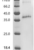 (Tris-Glycine gel) Discontinuous SDS-PAGE (reduced) with 5% enrichment gel and 15% separation gel.