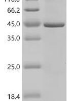 (Tris-Glycine gel) Discontinuous SDS-PAGE (reduced) with 5% enrichment gel and 15% separation gel.