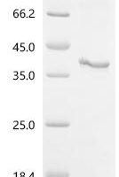 (Tris-Glycine gel) Discontinuous SDS-PAGE (reduced) with 5% enrichment gel and 15% separation gel.