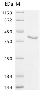 Recombinant Human STEAP1 protein (STEAP1) Protein, Homo sapiens (Human), in vitro E.coli expression system, C-terminal Twin-Strep-tagged, 42.9kDa, purity >85% as determined by SDS-PAGE.