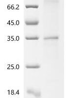 (Tris-Glycine gel) Discontinuous SDS-PAGE (reduced) with 5% enrichment gel and 15% separation gel.