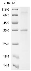 (Tris-Glycine gel) Discontinuous SDS-PAGE (reduced) with 5% enrichment gel and 15% separation gel.