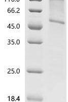 Recombinant Human Orexin receptor type 2 (HCRTR2) Protein - BioCrest Sci