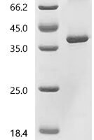Recombinant Human Asialoglycoprotein receptor 2 (ASGR2) Protein - BioCrest Sci