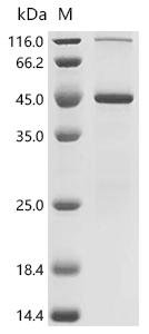 (Tris-Glycine gel) Discontinuous SDS-PAGE (reduced) with 5% enrichment gel and 15% separation gel.