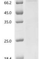 Recombinant Human CD44 antigen (CD44)-Detergent Protein - BioCrest Sci