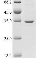 Recombinant Human Serine/threonine-protein phosphatase PGAM5,mitochondrial (PGAM5) (G166A,V167A,K169A) Protein - BioCrest Sci