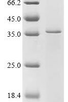 Recombinant Human Etoposide-induced protein 2.4 homolog (EI24) Protein - BioCrest Sci