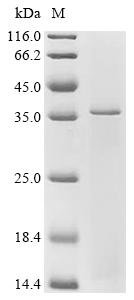 Recombinant Human Etoposide-induced protein 2.4 homolog (EI24) Protein, Homo sapiens (Human), in vitro E.coli expression system, N-terminal 6xHis-tagged, 39.8kDa, purity >90% as determined by SDS-PAGE.
