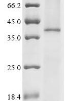 Recombinant Human C-X-C chemokine receptor type 1 (CXCR1) Protein - BioCrest Sci
