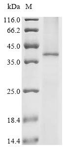 Recombinant Human C-X-C chemokine receptor type 1 (CXCR1) Protein, Homo sapiens (Human), in vitro E.coli expression system, N-terminal 10xHis-tagged, 41.3kDa, purity >85% as determined by SDS-PAGE.