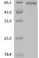 Recombinant Human Large neutral amino acids transporter small subunit 2 (SLC7A8) Protein - BioCrest Sci