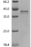 Recombinant Human Stearoyl-CoA desaturase (SCD) Protein - BioCrest Sci