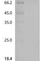 Recombinant Sheep P-selectin (SELP) Protein - BioCrest Sci