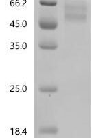 Recombinant Human Adenosine receptor A2a (ADORA2A)-Detergent Protein - BioCrest Sci